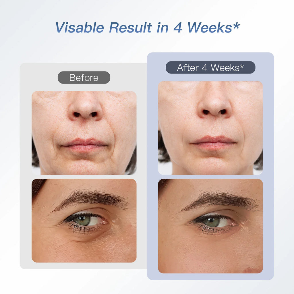 Sculptano M2 6-in-1 LED EMS Photon Rejuvenating Face Lifting Device