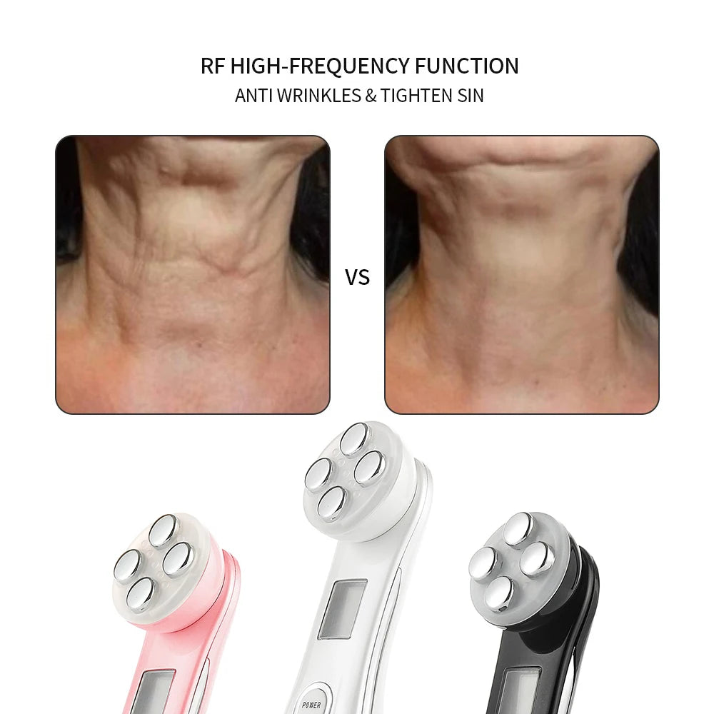Sculptano 5-in-1 RF & EMS Deep Electroporation Facial Lifting Device