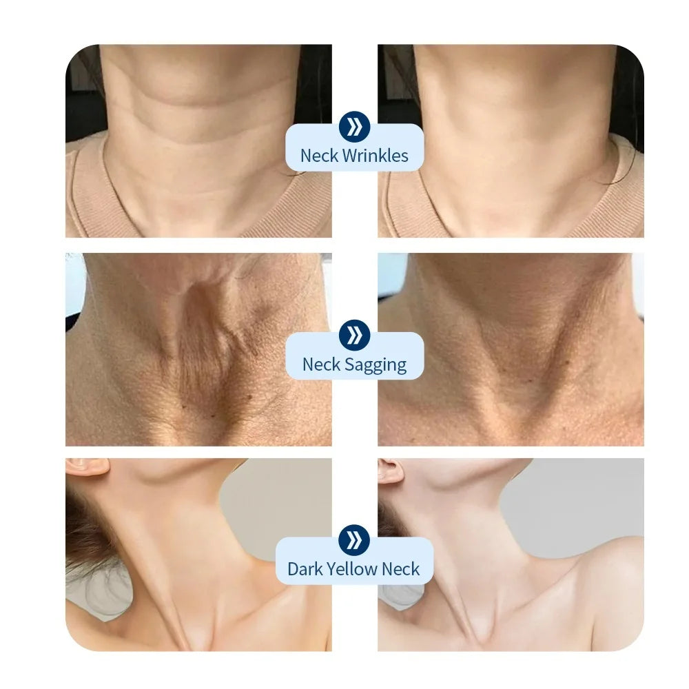 Sculptano 7-Color Bio-Light Photon Therapy Neck Mask