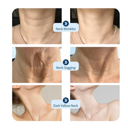 Sculptano 7-Color Bio-Light Photon Therapy Neck Mask