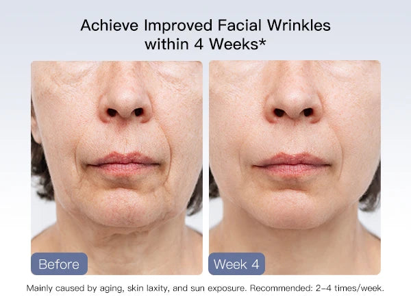 Sculptano M2 6-in-1 LED EMS Photon Rejuvenating Face Lifting Device