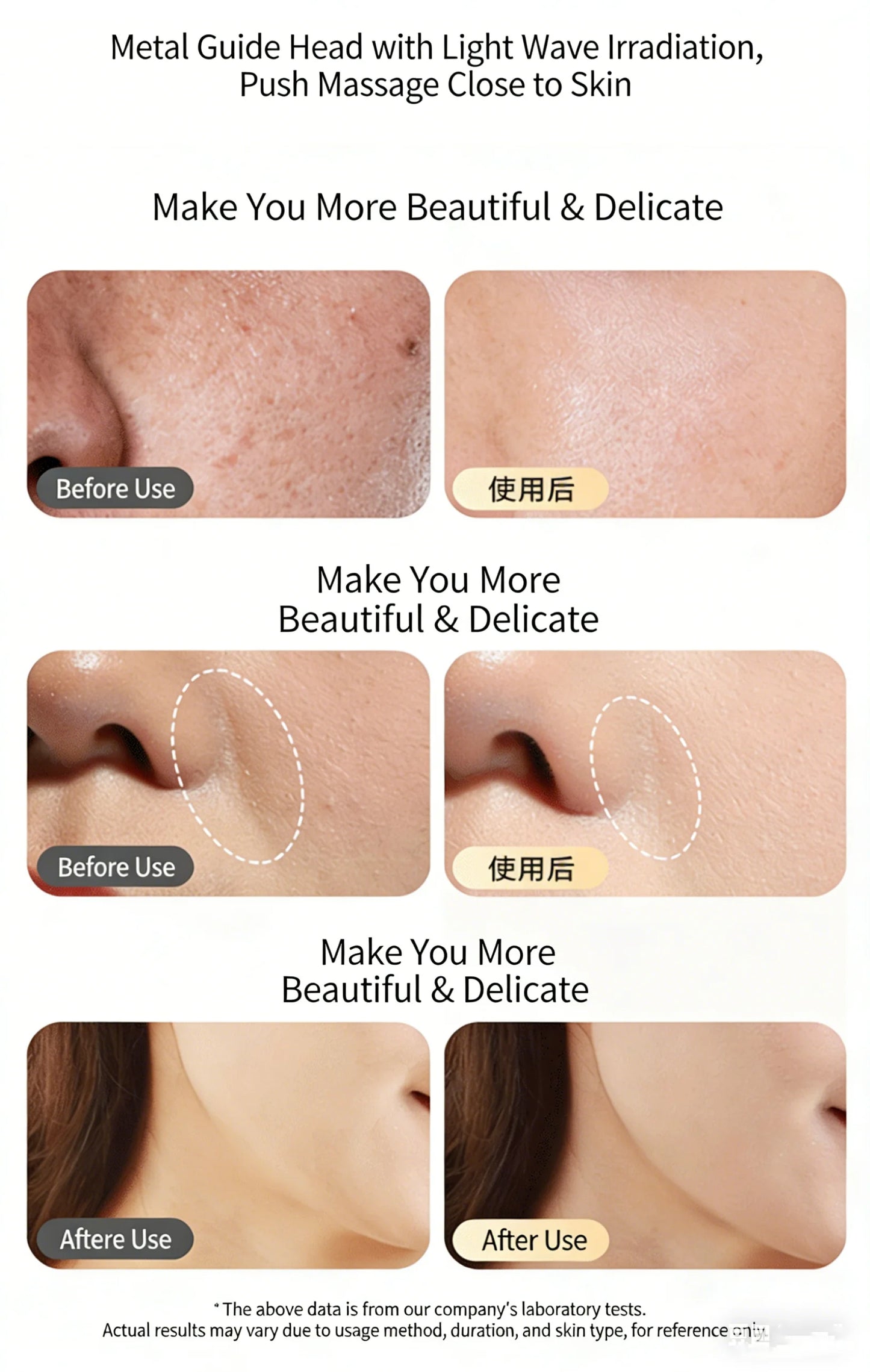 Sculptano M2 Non-Invasive Anti-Aging Photon Rejuvenating Device