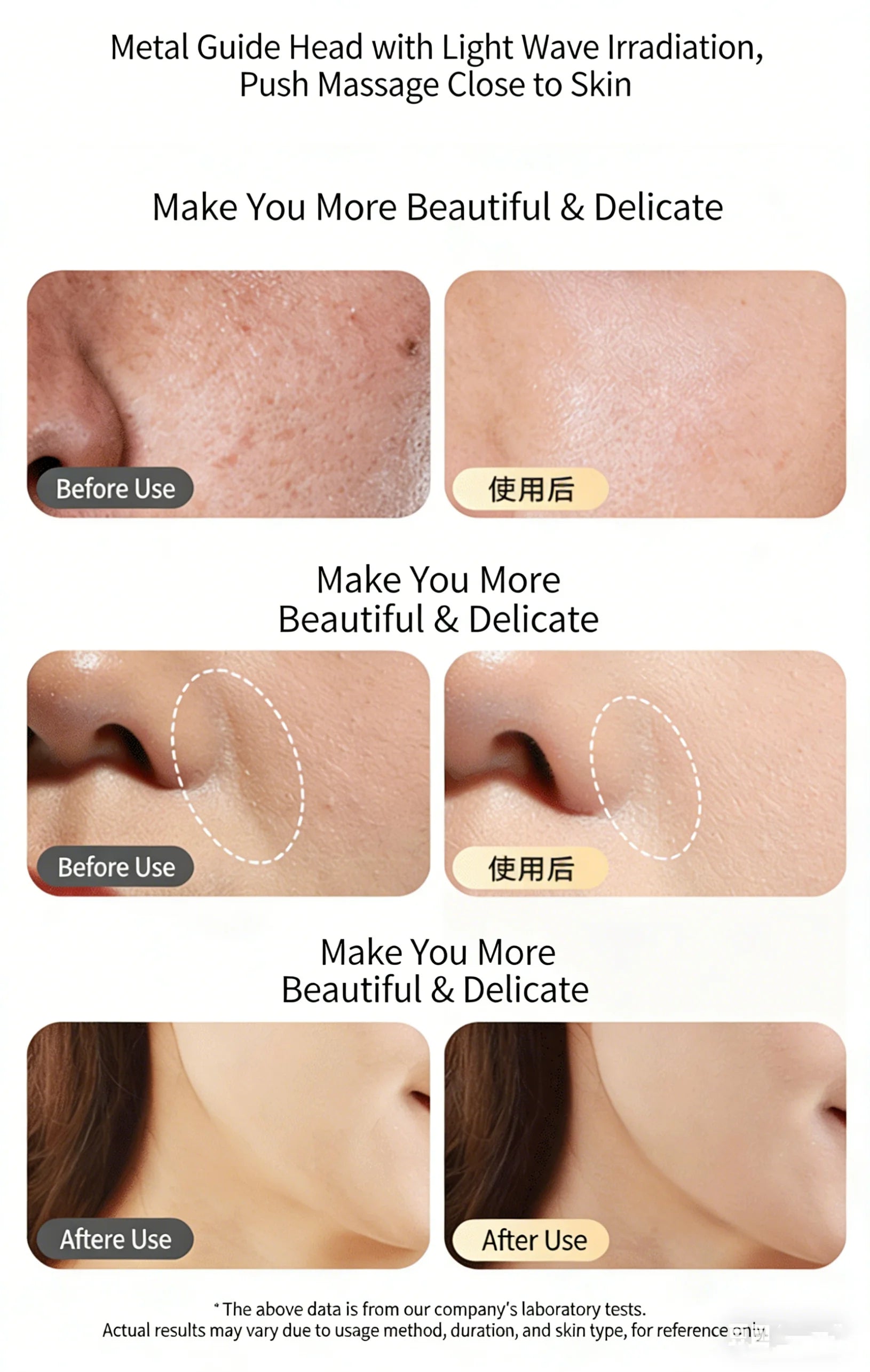 Sculptano M2 Non-Invasive Anti-Aging Photon Rejuvenating Device