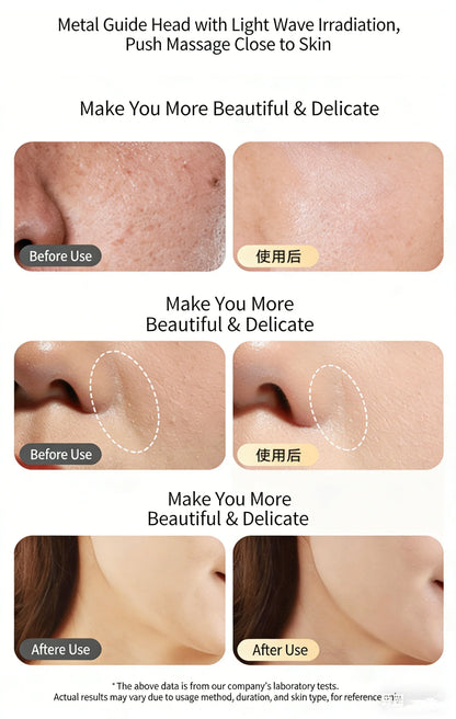 Sculptano M2 Non-Invasive Anti-Aging Photon Rejuvenating Device