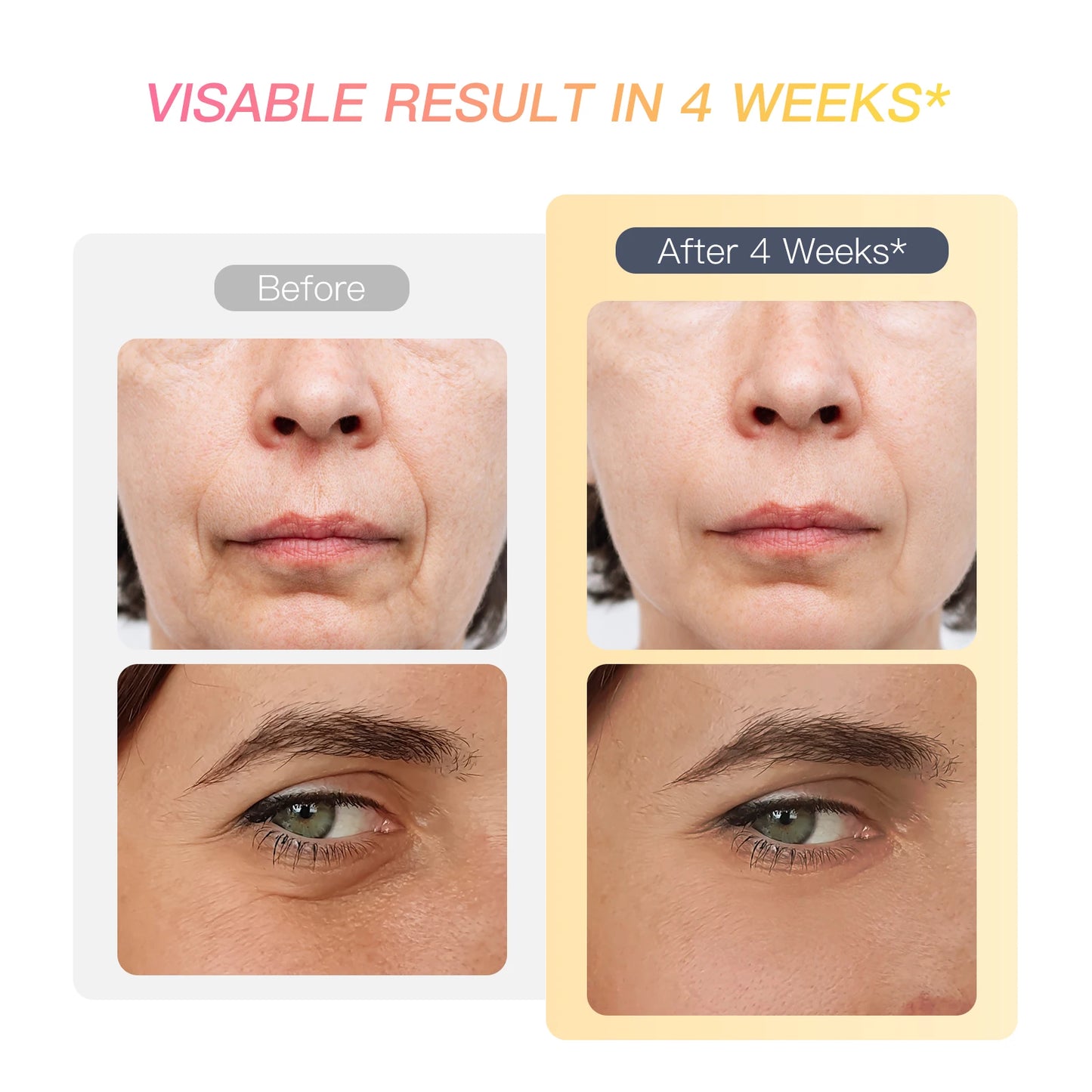 Sculptano M2 6-in-1 LED EMS Photon Rejuvenating Face Lifting Device